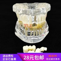 치아모형 재료상 입모형 모양 치과구강재료 치아수업모델 투명수지 병리복구 임플란트