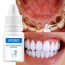 치아 미백 세럼 파우더 구강 위생을 효과적으로 청소 치과 플라크 얼룩 제거 노란색 치료 도구, 없음
