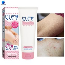 닭살피부 바디로션 보습제 모공각화증 크림 고보습 여름 겨울 악건성 등로션 보습 건조 제거, 닭살피부 바디크림