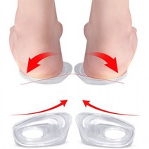 오다리 교정 깔창 휜다리 안짱다리 패드 쿠션 발바닥, 상품선택, 투명