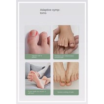 내성발톱와이어 내성발톱교정기 30PCS 안티 팽창 큰 발가락 자란 발톱 교정기 스티커 풋 케어 제품 패치 수정 네일 스트립, [03] 150PCS