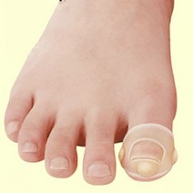 내성발톱 테이프 밴드
