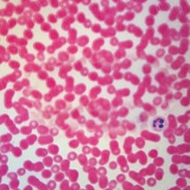 (JLS) 종단 해바라기줄기 영구프레파라트 (75x25mm) 1매 물관염색 식물프레파라트 현미경용 슬라이드표본 박편 절편 표본