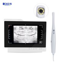 구강 카메라 내시경 치과 치과 구강 카메라 USB 유선 엑스레이 필름 리더 구강 관찰 장비 내장 내시경, 한개옵션1, 한개옵션0