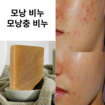 유러디아 포리모 비누 딥클렌징 모낭충 비누 모냥염 비누, 100g x 2개