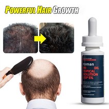 탈모에센스 샴푸 60ml 빠른 모발 성장 에센스 천연 허브 건강 트리트먼트 탈모 성장을 길고 두꺼운 케어 제품, [03] 60ml