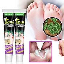 BT 무좀약 연고 발톱무좀 치료 발냄새 제거 발 가려움 연고, 20ml, 3개