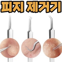 코피지 뽑기 압출 제거기 얼굴 블랙헤드 압출기, L형