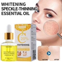 화이트닝세럼 앰플 모공수축 피부결 30ml 비타민 C 세럼 페이스 화이트닝 페이셜 히알루론 다크 케어 산 스팟 리무버 오일 스킨 V5D7, [01] 30ml