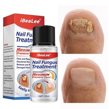 손발톱 무좀 치료제 진균 리페어에센스 발톱 케어제 발톱연화, 20ml*3개, 3개