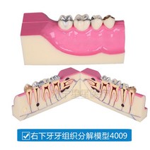 치아 모형 교육 치위생 관리 모양 덴티폼 치과놀이 구강 재료상, M4009