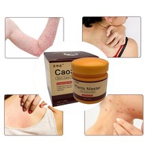 ZB 20g Plants Master Skin Care Cream For Psoriasis Eczema Balm Dermatitis Relief Rash Itching Herbal