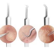 피지 제거기 여드름 짜는도구 짜기 코 얼굴 블랙헤드 압출 바늘 집게 짜개 피부과 압출기, 갈고리형, a>상품선택<z