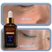 주름펴지는 화장품 EGF 앰플 효능 콜라겐 세럼 목세로주름 이마 잔주름 미간주름 제거