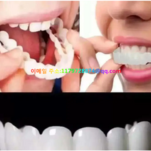 [ 가완이일홈마니 ]식사 신기 통용 이가 빠지다 임시 가리기 앞니 모다, 윗니 커버