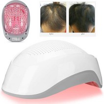 led 두피 탈모 헤어 관리 모발 재성장 레이저 헬멧 탈모 치료 캡 180 led 모자 장치 탈모치료 탈모헬멧 모, 한개옵션0