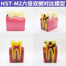 구강 치아 모형 치과 병원 시연 설명 교육용 모형 소품, 6배 양측 대조