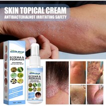 바디크림 허브 항진균 스프레이 살리실산 에센스 항 가려움증 치료 건선 피부염 습진 피부, 30ml, 1개