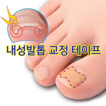 내성발톱 교정 테이프, 100개입