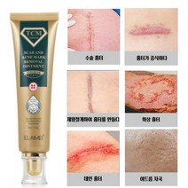 ELAIME 흉터제거연고 수술 상처 켈로이드 흉터 화상, 30g, 1