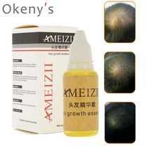 탈모예방 여성탈모 남자탈모 남성탈모 모근강화 발모 모발 탈모 탈모방지 샴푸 기 능성 탈모기능성 탈모샴푸순위 헤어토닉 헤어에센스 헤어오일 aimeizi 모발