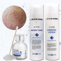 스킨아이 AC 퓨어 워터리 토너 + 에센셜 로션 화이트파우더 SET (여드름 기초 스킨케어 3종 SET), 1set