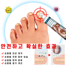 문제성 손 발톱 무좀 치료 두꺼워짐 곰팡이 리페어 연고, 1개, 30ml