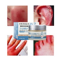 일본의 수입원료 동상연고 동상 치료 동상치료연고 발 뒤꿈치 갈라짐 손가락 갈라짐