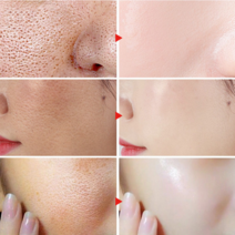 Pore Shrinking Serum Skin Elasticity Delicate Repair Essence Clean Blackheads Acne Moisturizing Smoo, 03 5ml