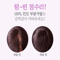 정수리 인모 부분 반가발 볼륨업 스타일링 원형 엠자 O형 탈모 커버 앞 뒷머리 옆머리 흰머리 새치 내츄럴 레드 브라운 컬러 뒤통수 잔머리 중년 무대 공연 남자 여자 남성 여성 편한, 레드브라운