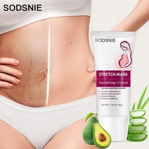 튼살매트크림 튼살제거 바디라인 처진 피부개선 부드러움 리프팅 탄력 바디케어