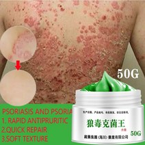 건선크림 아토피 피부습진 완화 크림 가려움방지 크림 보습제, 50 그램