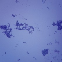 (JLS) 폐렴균 영구프레파라트 (75x25mm) 1매 그람양성쌍구균 프레파라트 현미경용 슬라이드표본 박편 절편 표본