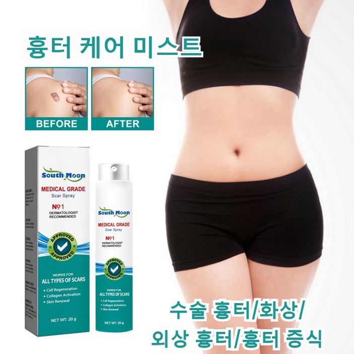 흉터 케어 미스트 수술흉터 화상물집 쌍꺼풀흉터 제왕절개흉터 흉터제거연고 재생크림 과민성 흉터흉터 증식, 3개