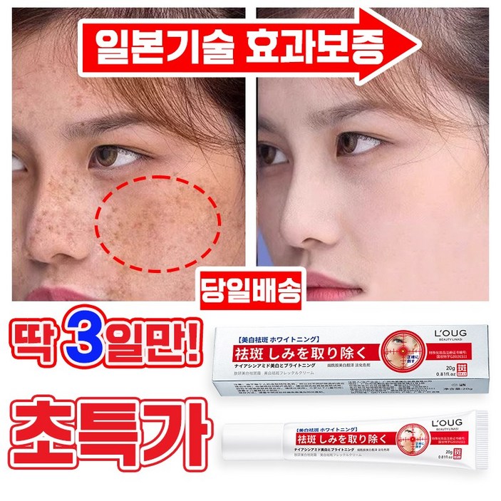 국내배송 일본 11122 기미 크림 잡티 주근깨 검버섯 제거 미백 크림 색소침착 화이트닝 피부 개선 포장증정