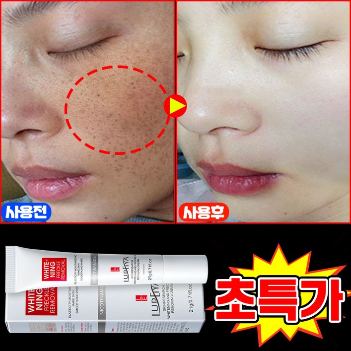 [100% 효과있음] 멜라논 크림 기미크림 기미 잡티 주근깨 검버섯 제거 크림 착색 미백 크림 들깨기미크림 색소침착 화이트닝 LUPEIYA 포장증정