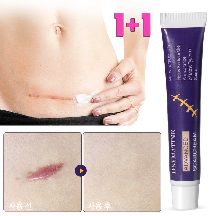 당일배송 DRYMATINE 흉터연고 흉터제거연고 재생크림 상처흉터연고 여드름흉터 수술흉터 화상물집 흉터제거연고 20g, 20ml, 2개 당일배송 DRYMATINE 흉터연고 흉터제거연고 재생크림 상처흉터연고 여드름흉터 수술흉터 화상물집 흉터제거연고 20g, 20ml, 2개