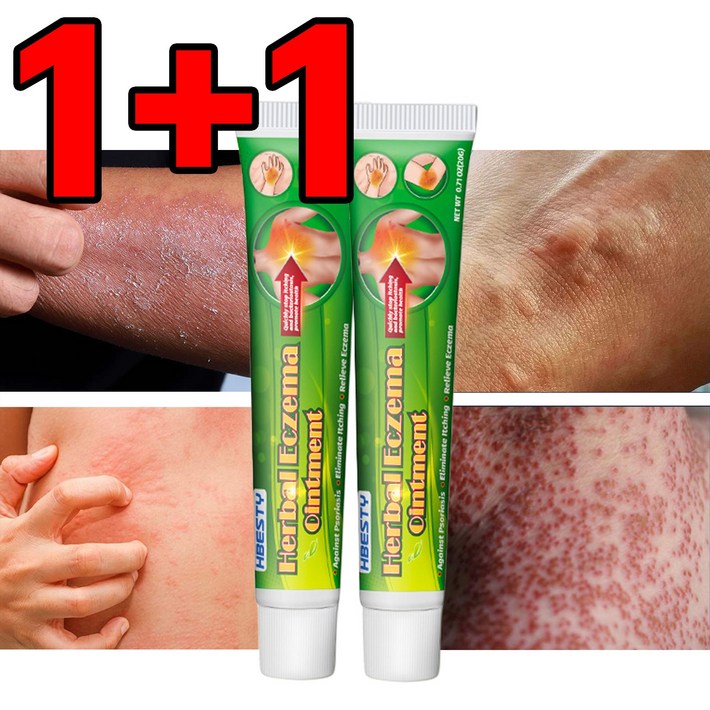 당일배송 KORELAN 11 피부건선 가려움증 습진연고 피부 가려움증 당일배송 KORELAN 11 피부건선 가려움증 습진연고 피부 가려움증