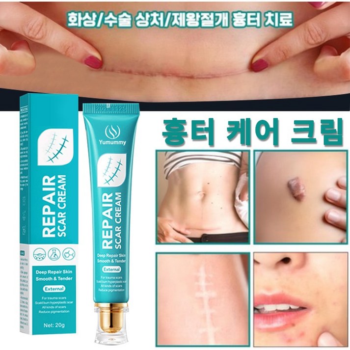 흉터제거연고화상수술흉터 흉터 연고 화상연고, 2개, 20g