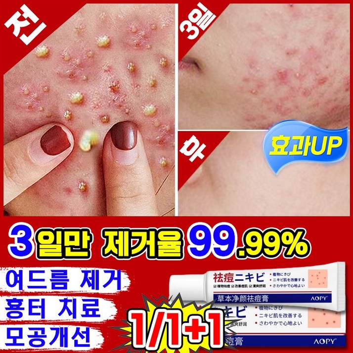 [당일출고] 일본 여드름 연고 횽터 제거 치료 리페어 연고 좁쌀여드름 등드름 피지 케어 얼굴 피부 재생 크림 색소침착 모공 개선