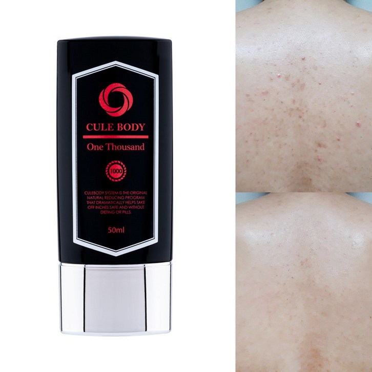 스피큘엑스 등드름 가드름 큘바디 크림 바디 해초 필링 셀프 박피, 1개, 50ml