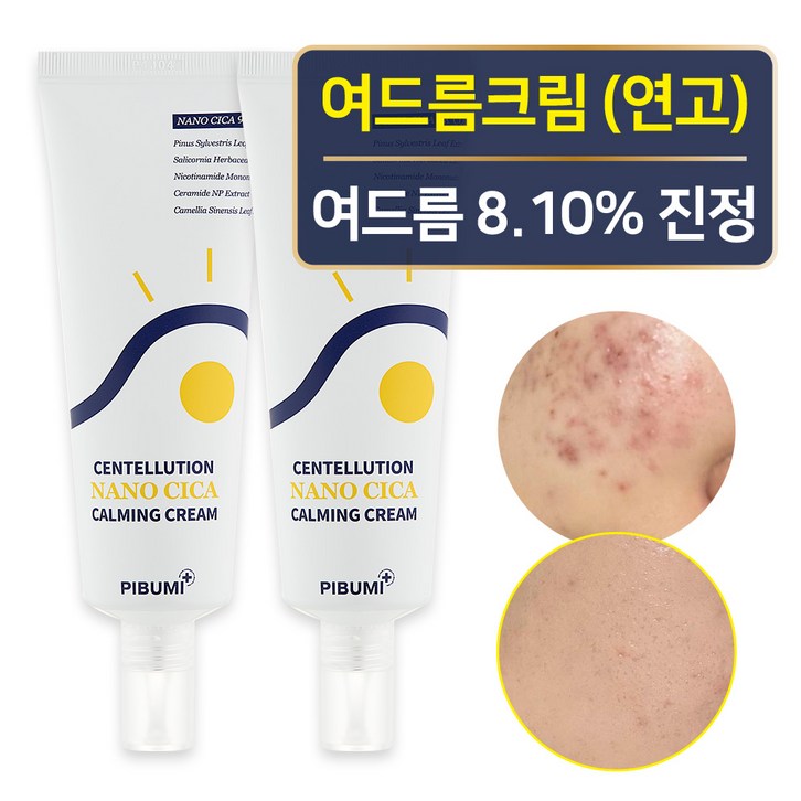 피부미 나노시카 트러블 카밍 크림 좁쌀 여드름 흉터 요철 제거, 70ml, 2개 피부미 나노시카 트러블 카밍 크림 좁쌀 여드름 흉터 요철 제거, 70ml, 2개