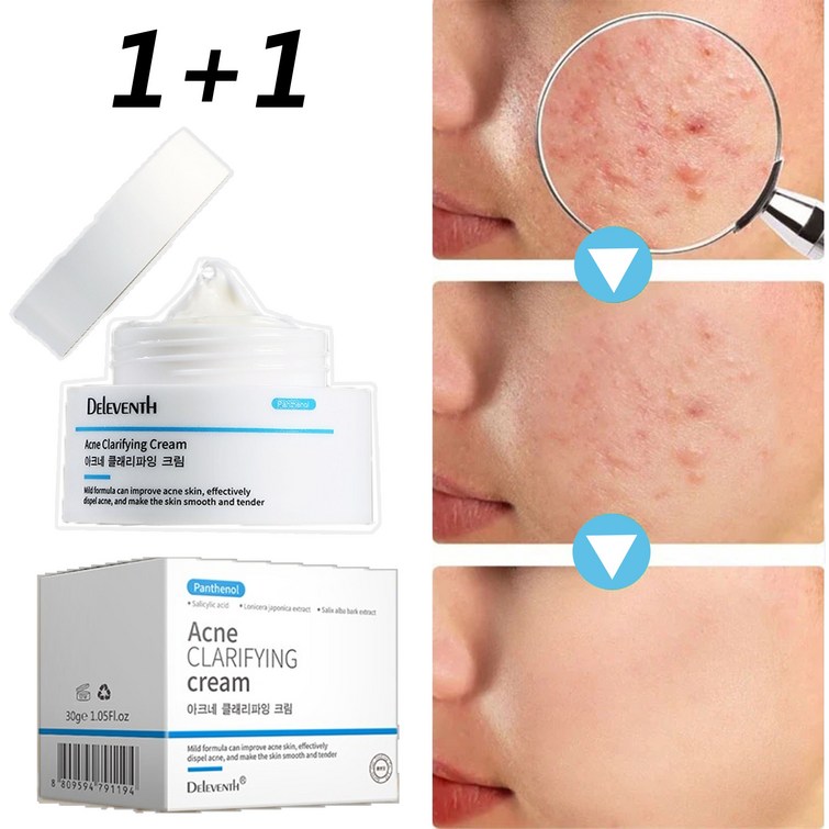 트러블 극복 99.99제거효과 천연 식물 성분여드름흉터 리페어 크림 트러블 자국민감피부 개선, 2개, 30g